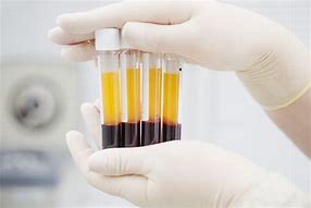 How to grow Platelet in our human body